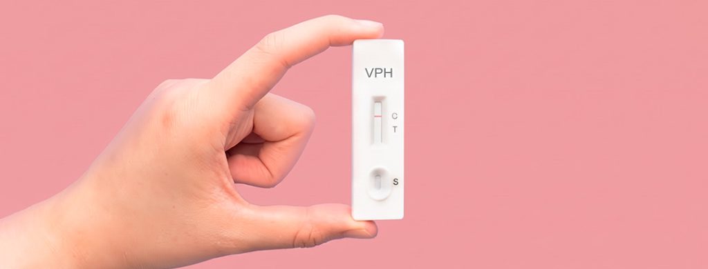 La mejor forma de saber si tienes VPH es a través de pruebas de laboratorio
