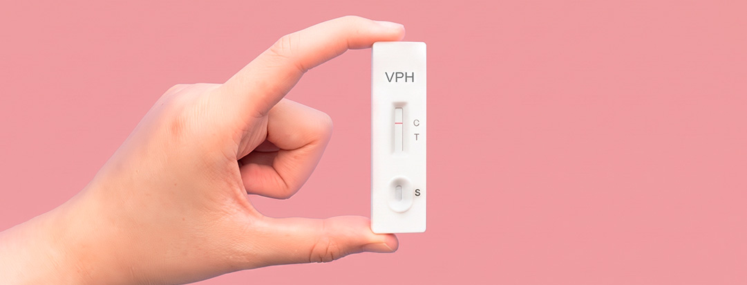 La mejor forma de saber si tienes VPH es a través de pruebas de laboratorio