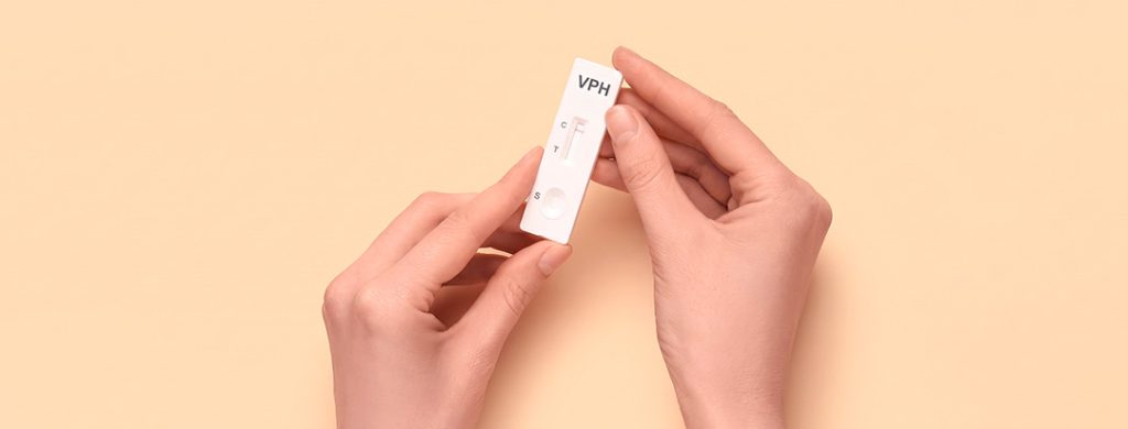 Un resultado positivo para  VPH necesita atención por parte de especialistas 